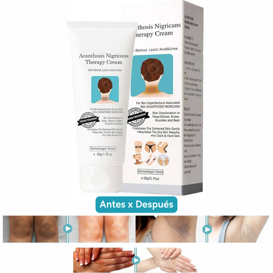 SkinGlow™ - Crema Aclarante Blanqueadora
